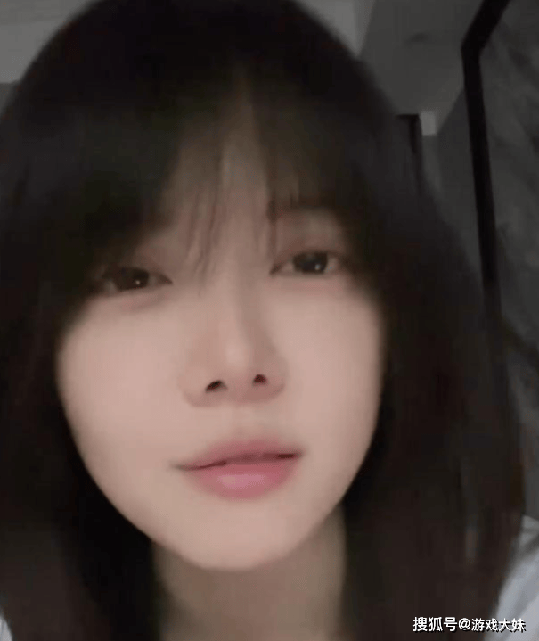 骆歆素颜直播,被夸颜值很高,展示身上多处淤青